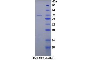 SDS-PAGE analysis of Human Topoisomerase II Protein.