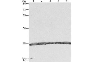 Western blot analysis of Hela, 293T and MCF7 cell, human fetal brain tissue and Jurkat cell, using PRDX3 Polyclonal Antibody at dilution of 1:800 (Peroxiredoxin 3 抗体)