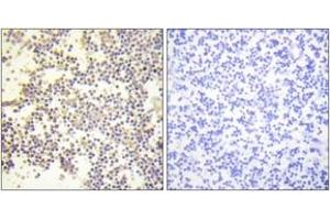 Immunohistochemistry analysis of paraffin-embedded human tonsil, using Neutrophil Cytosol Factor 1 (Phospho-Ser328) Antibody.