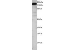 Image no. 1 for anti-Maternal Embryonic Leucine Zipper Kinase (MELK) (AA 639-651) antibody (ABIN290640) (MELK 抗体  (AA 639-651))