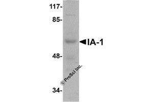 Western Blotting (WB) image for anti-Insulinoma-Associated 1 (INSM1) (N-Term) antibody (ABIN1031405) (INSM1 抗体  (N-Term))
