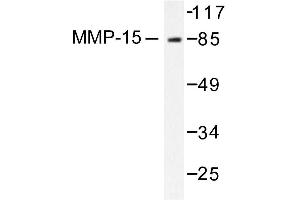 Image no. 1 for anti-Matrix Metallopeptidase 15 (Membrane-inserted) (MMP15) antibody (ABIN265526) (MMP15 抗体)