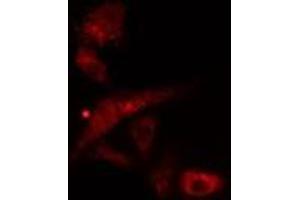 ABIN6277078 staining  Hela cells by IF/ICC. (LYN 抗体  (C-Term))
