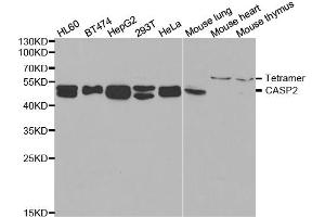 Western blot analysis of extracts of various cell lines, using CASP2 antibody. (Caspase 2 抗体)