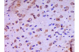 Paraformaldehyde-fixed, paraffin embedded Mouse brain Antigen retrieval by boiling in sodium citrate buffer (pH6. (JAM3 抗体  (AA 31-130))