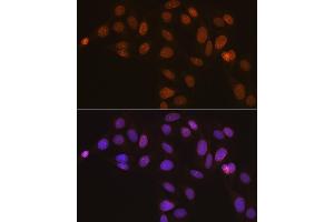 Immunofluorescence analysis of U-2 OS cells using Lamin B2 Rabbit mAb (ABIN1679310, ABIN3019324, ABIN3019325 and ABIN7101750) at dilution of 1:100 (40x lens).