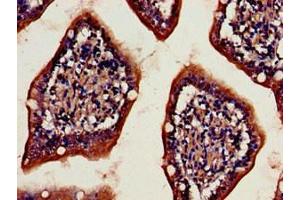 Immunohistochemistry of paraffin-embedded human small intestine tissue using ABIN7149984 at dilution of 1:100