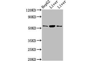 Western Blot Positive WB detected in: HepG2 whole cell lysate, Rat liver tissue, Mouse liver tissue All lanes: GPT antibody at 4. (ALT 抗体  (AA 2-496))