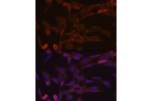 Immunofluorescence analysis of NIH-3T3 cells using Inhibin beta A (INHBA) (INHBA) Rabbit mAb (ABIN7267870) at dilution of 1:100 (40x lens). (INHBA 抗体)