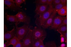 Immunofluorescence staining of methanol-fixed MCF cells using Phospho-ESR1-S167 antibody. (Estrogen Receptor alpha 抗体  (pSer167))