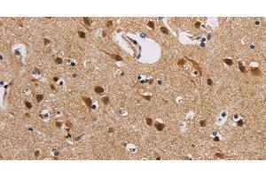Immunohistochemistry of paraffin-embedded Human brain using IL19 Polyclonal Antibody at dilution of 1:40 (IL-19 抗体)