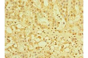 Immunohistochemistry of paraffin-embedded human adrenal gland tissue using ABIN7175978 at dilution of 1:100 (ZBTB32 抗体  (AA 1-294))