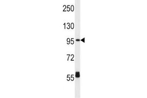 CPT1C antibody western blot analysis in HL-60 lysate. (CPT1C 抗体  (AA 596-625))