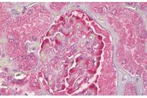 Immunohistochemistry (IHC) image for anti-Nucleolar Protein 3 (Apoptosis Repressor with CARD Domain) (NOL3) (AA 159-208) antibody (ABIN2878890)