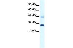 PREB antibody used at 1. (PREB 抗体  (N-Term))