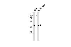 Western blot analysis of lysates from Hela cell line and human placenta tissue lysate (from left to right), using IDH3B Antibody at 1:1000 at each lane. (IDH3B 抗体  (N-Term))