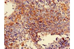 Immunohistochemistry (IHC) image for anti-Mannosidase, Alpha, Class 2A, Member 1 (MAN2A1) (AA 31-181) antibody (ABIN7143899)