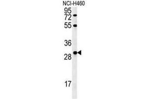 Western Blotting (WB) image for anti-Fibroblast Growth Factor 2 (Basic) (FGF2) (AA 37-66), (Middle Region) antibody (ABIN952306)