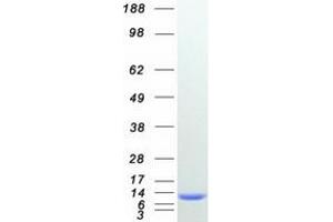 Western Blotting (WB) image for S100 Calcium Binding Protein A1 (S100A1) protein (Myc-DYKDDDDK Tag) (ABIN2731290)