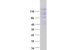 Western Blotting (WB) image for Ataxin 2-Like (ATXN2L) (Transcript Variant C) protein (Myc-DYKDDDDK Tag) (ABIN2715016)