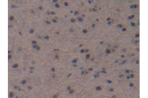 DAB staining on IHC-P; Samples: Mouse Brain Tissue (NPPC 抗体  (AA 30-126))