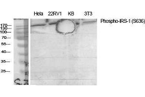 Western Blot (WB) analysis of specific cells using Phospho-IRS-1 (S636) Polyclonal Antibody. (IRS1 抗体  (pSer636))