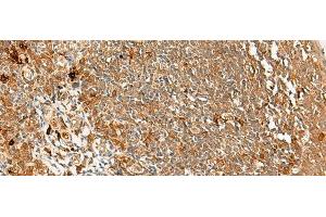 Immunohistochemistry of paraffin-embedded Human tonsil tissue using METTL17 Polyclonal Antibody at dilution of 1:60(x200) (METTL17 抗体)