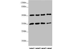 Western blot All lanes: MTX1 antibody at 3. (Metaxin 1 抗体  (AA 217-466))