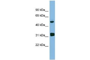 WB Suggested Anti-LYAR Antibody Titration: 0. (LYAR 抗体  (Middle Region))