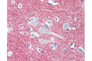 Immunohistochemistry (IHC) image for anti-Signal-Regulatory Protein alpha (SIRPA) antibody (ABIN1804695)