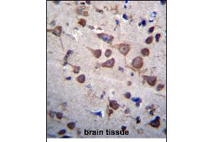 Immunohistochemistry (Paraffin-embedded Sections) (IHC (p)) image for anti-Phosphatidylinositol Glycan Anchor Biosynthesis, Class A (PIGA) (AA 455-484), (C-Term) antibody (ABIN656312)