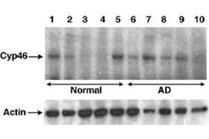 Western blot analysis of CYP46A1 in human brain lysates using CYP46A1 polyclonal antibody . (CYP46A1 抗体)