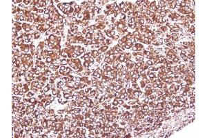 IHC-P Image Immunohistochemical analysis of paraffin-embedded HEP3B xenograft, using GRP94, antibody at 1:100 dilution. (GRP94 抗体  (C-Term))