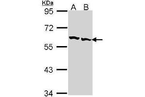WB Image Sample (30 ug of whole cell lysate) A: Hep G2 , B: Raji 7. (CCT2 抗体)
