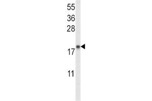 Western Blotting (WB) image for anti-Natriuretic Peptide A (NPPA) antibody (ABIN2917623)