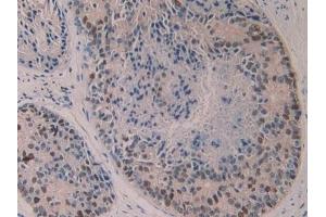 Immunohistochemistry (IHC) image for anti-Arachidonate 5-Lipoxygenase (ALOX5) (AA 461-671) antibody (ABIN7433525)