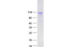 Western Blotting (WB) image for BEN Domain Containing 3 (BEND3) protein (Myc-DYKDDDDK Tag) (ABIN2715221)