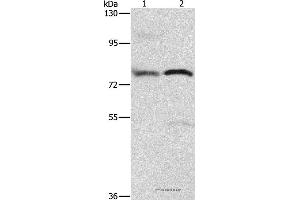 Western blot analysis of 293T cell and human fetal brain tissue, using ATXN1 Polyclonal Antibody at dilution of 1:800