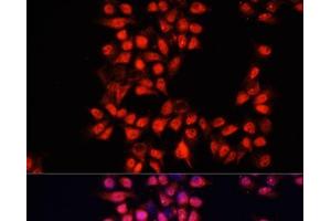 Immunofluorescence analysis of HeLa cells using ADAM10 Polyclonal Antibody at dilution of 1:100. (ADAM10 抗体)
