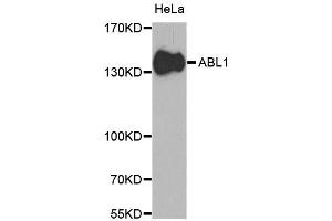 Western blot analysis of extracts of HeLa cells, using ABL1 antibody (ABIN5970109) at 1/1000 dilution. (ABL1 抗体  (C-Term))