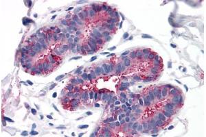 Immunohistochemistry (IHC) image for anti-G Protein-Coupled Receptor, Family C, Group 5, Member A (GPRC5A) (Cytoplasmic Domain) antibody (ABIN1048906)