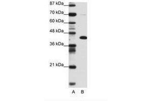 Image no. 1 for anti-Zinc Finger and BTB Domain Containing 25 (ZBTB25) (AA 181-230) antibody (ABIN6736153) (ZBTB25 抗体  (AA 181-230))