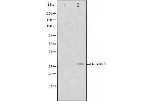 Western blot analysis on HeLa cell lysate using Galectin 3 Antibody,The lane on the left is treated with the antigen-specific peptide. (Galectin 3 抗体  (Internal Region))