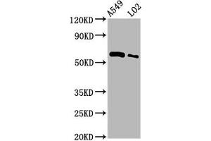 Western Blot Positive WB detected in: A549 whole cell lysate, LO2 whole cell lysate All lanes: PARP3 antibody at 3. (PARP3 抗体  (AA 1-240))