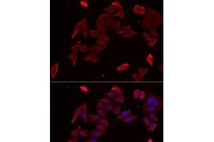 Immunofluorescence analysis of MCF7 cells using PDHX Polyclonal Antibody (PDHX 抗体)