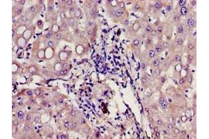 Immunohistochemistry of paraffin-embedded human liver tissue using ABIN7154509 at dilution of 1:100 (Growth Hormone Receptor 抗体  (AA 19-184))