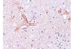 Immunohistochemical staining of human brain tissue with ZC3H12C polyclonal antibody  at 5 ug/mL dilution. (ZC3H12C 抗体  (N-Term))