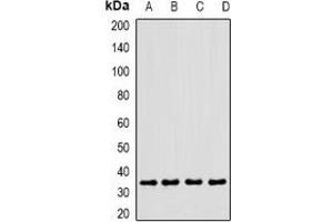 Western blot analysis of CLEC12A expression in MCF7 (A), U937 (B), mouse heart (C), rat liver (D) whole cell lysates. (CLEC12A 抗体)