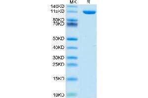 NRP2 Protein (AA 23-859) (His tag)