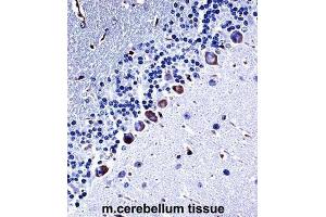 Immunohistochemistry (IHC) image for anti-Casein Kinase 1, gamma 3 (CSNK1G3) antibody (ABIN2997618) (CSNK1G3 抗体)